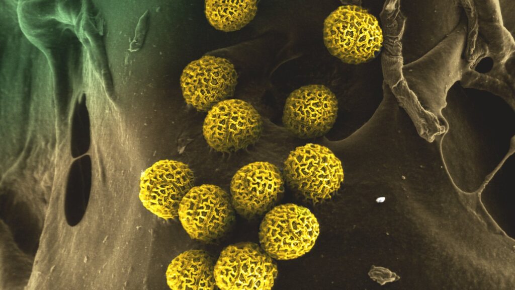 pollen grains under a microscope