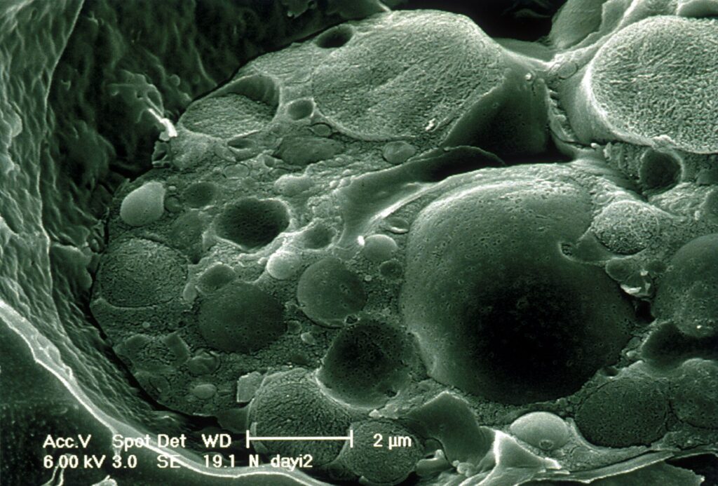Darwin's Frog (Rhinoderma darwinii): The Frog That Raises Its Young in Its Mouth 20 Scanning electron micrograph of Batrachochytrium dendrobatidis, the chytrid fungus that attacks amphibian skin