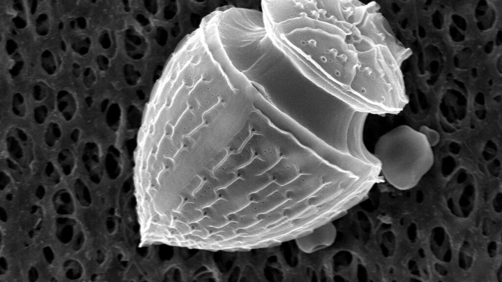 Dinoflagellate under the electron microscope